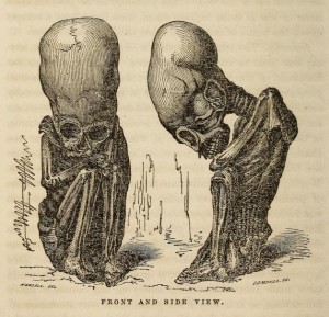 2011_Marzulli_Rivero_Peruvian_antiquities_fetus_figure