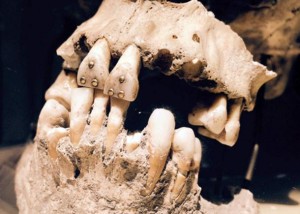 2016_Qalert_Ecuador_Gold-studded-teeth