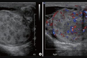 2016_Hal_Turner_Testical-Lesion-Image